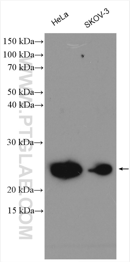 Western Blot (WB) analysis of HeLa cells using UBE2T/HSPC150 Polyclonal antibody (10105-2-AP)
