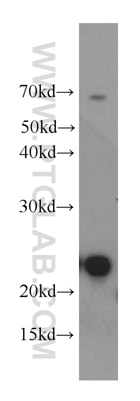 Western Blot (WB) analysis of HeLa cells using UBE2T/HSPC150 Polyclonal antibody (10105-2-AP)