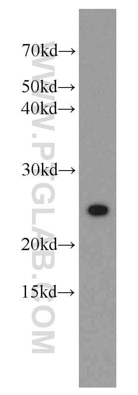 Western Blot (WB) analysis of Jurkat cells using UBE2T/HSPC150 Polyclonal antibody (10105-2-AP)