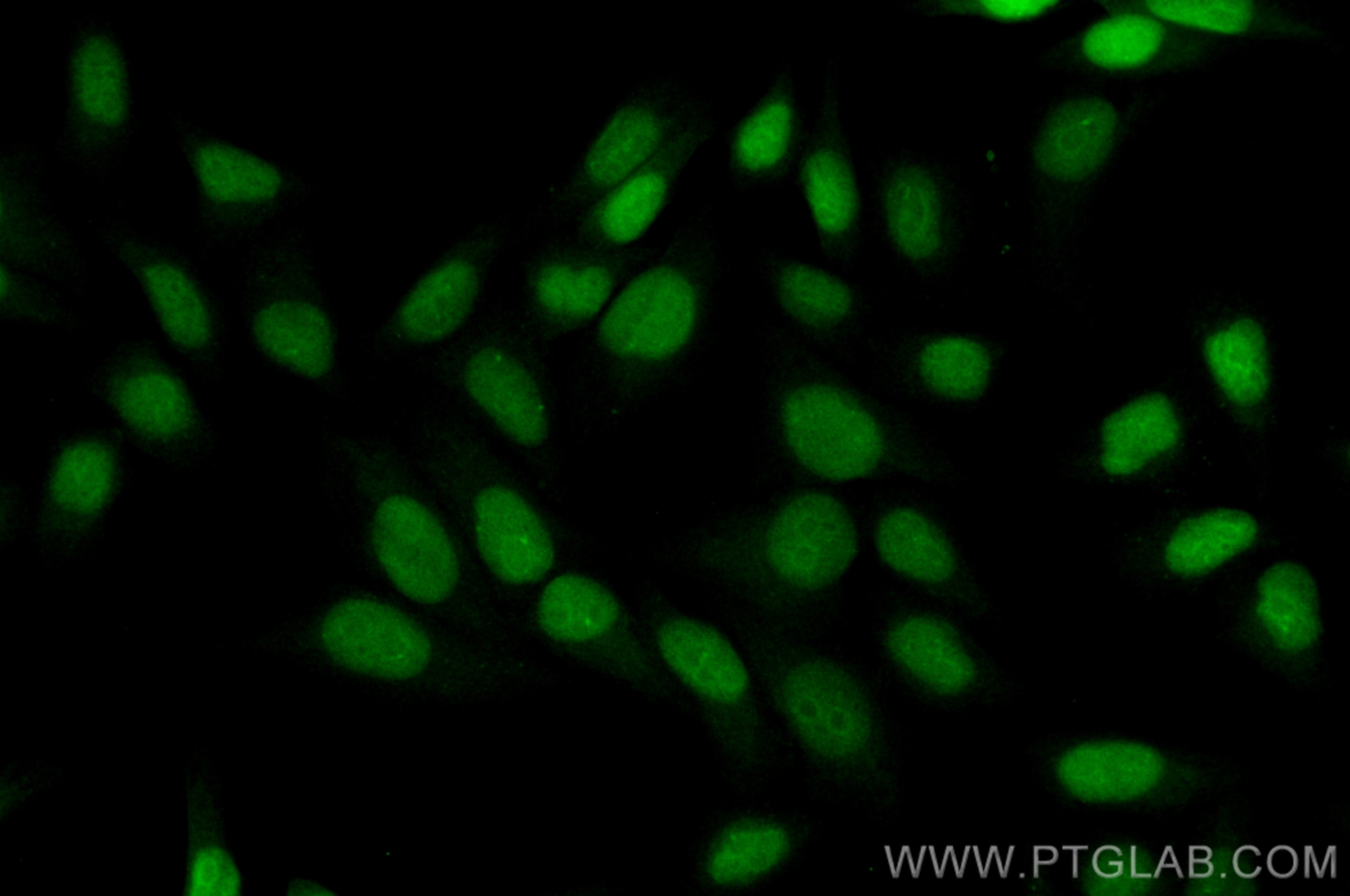 Immunofluorescence (IF) / fluorescent staining of HepG2 cells using CoraLite® Plus 488-conjugated UBE2T/HSPC150 Polycl (CL488-10105)