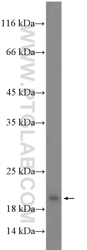 Western Blot (WB) analysis of BxPC-3 cells using UBE2V1 Polyclonal antibody (10207-2-AP)