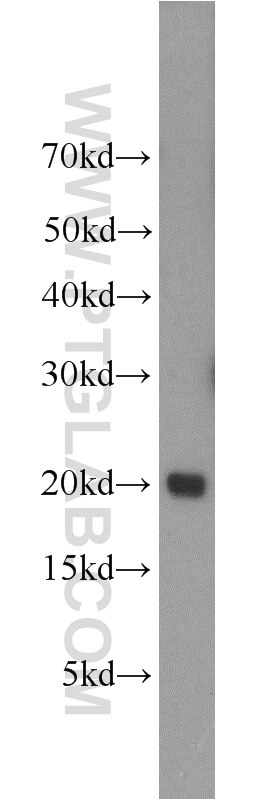 Western Blot (WB) analysis of human spleen tissue using UBE2V1 Polyclonal antibody (10207-2-AP)