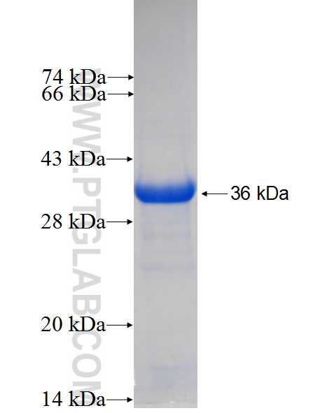 UBE2V1 fusion protein Ag0278 SDS-PAGE