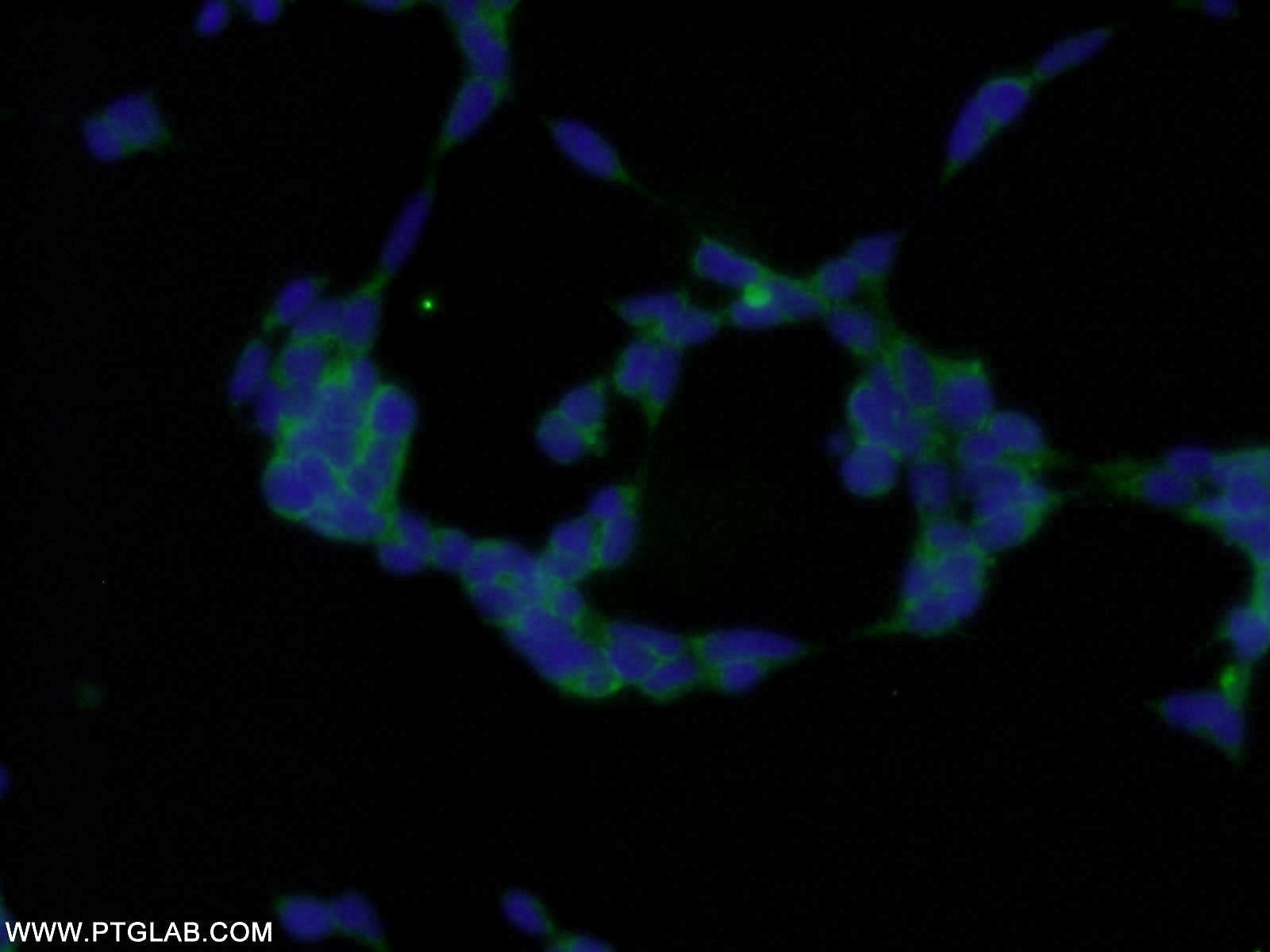 Immunofluorescence (IF) / fluorescent staining of HEK-293 cells using MMS2 Polyclonal antibody (10689-1-AP)