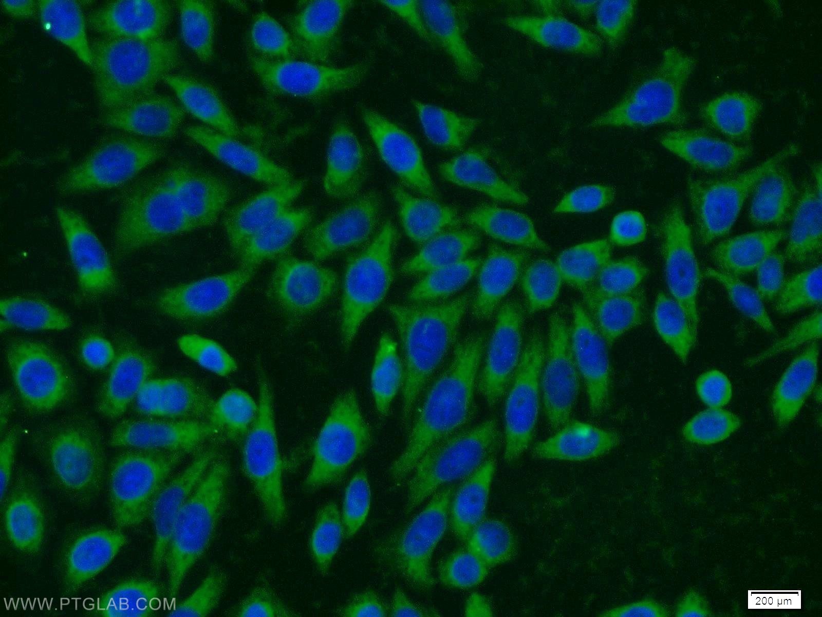 Immunofluorescence (IF) / fluorescent staining of HeLa cells using MMS2 Polyclonal antibody (10689-1-AP)