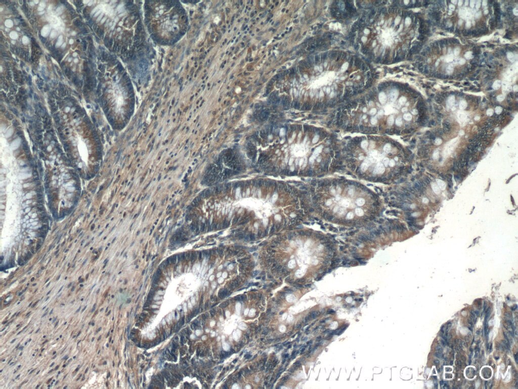 IHC staining of human colon using 10689-1-AP