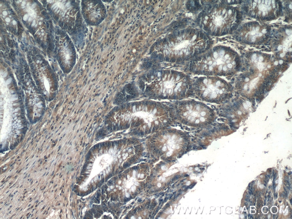 Immunohistochemistry (IHC) staining of human colon tissue using MMS2 Polyclonal antibody (10689-1-AP)