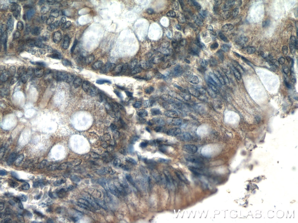 Immunohistochemistry (IHC) staining of human colon tissue using MMS2 Polyclonal antibody (10689-1-AP)