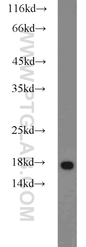 WB analysis of HeLa using 10689-1-AP