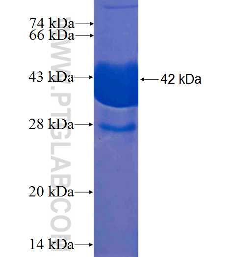 UBE2V2 fusion protein Ag1111 SDS-PAGE