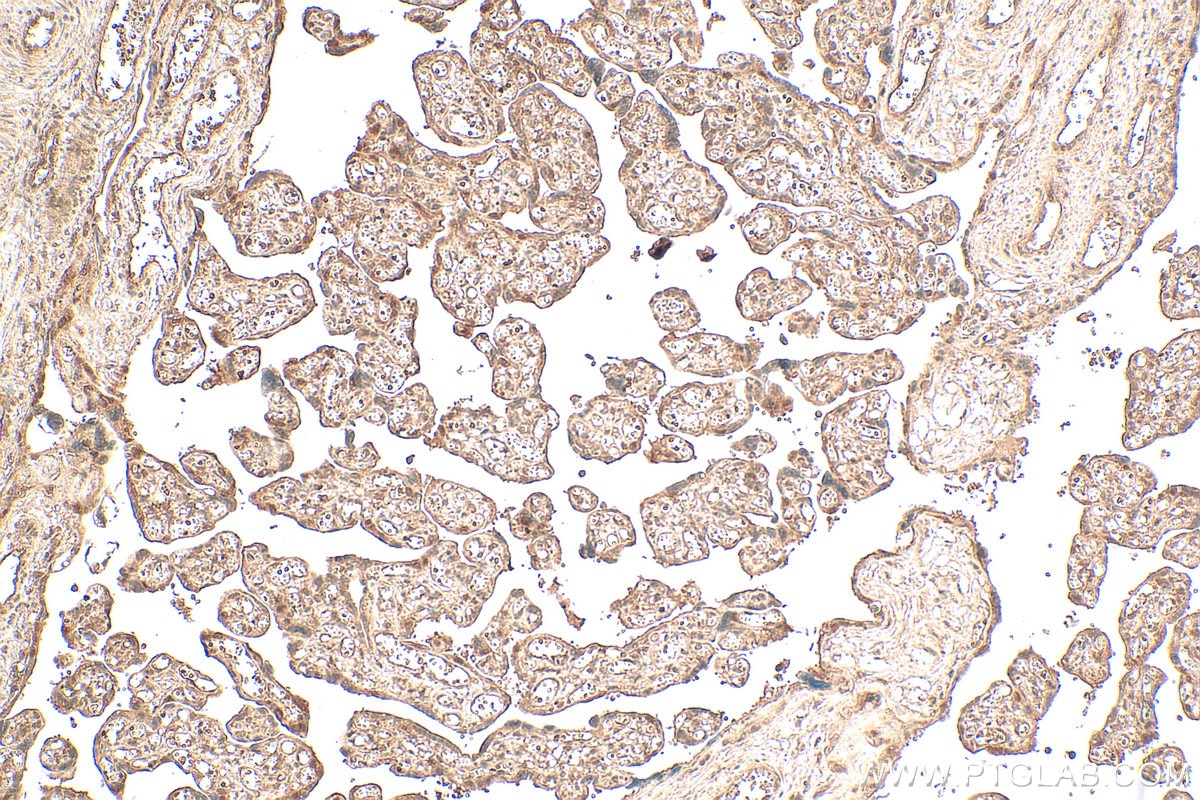 Immunohistochemical analysis of paraffin-embedded human placenta tissue slide using 16928-1-AP (UBE2Z antibody) at dilution of 1:200 (under 10x lens). Heat mediated antigen retrieval with Tris-EDTA buffer (pH 9.0). Immunohistochemistry (IHC) staining of human placenta tissue using UBE2Z Polyclonal antibody (16928-1-AP)