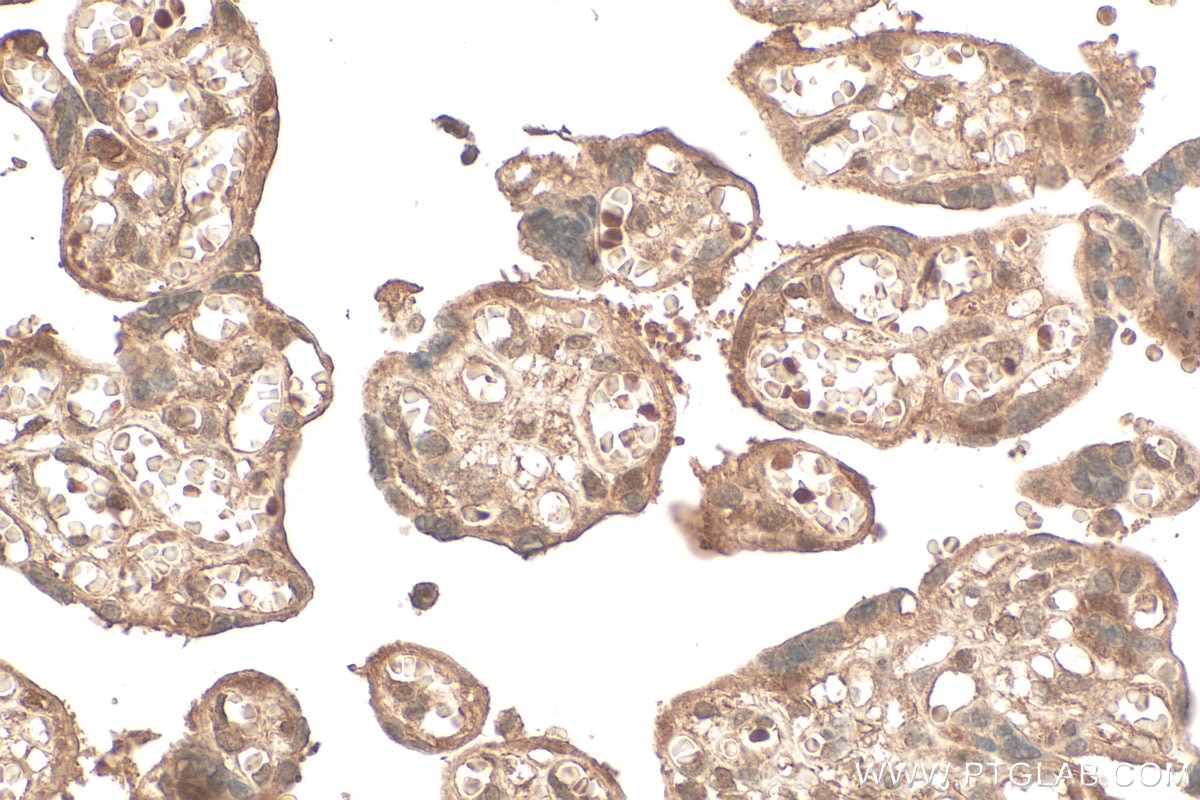 Immunohistochemical analysis of paraffin-embedded human placenta tissue slide using 16928-1-AP (UBE2Z antibody) at dilution of 1:200 (under 40x lens). Heat mediated antigen retrieval with Tris-EDTA buffer (pH 9.0). Immunohistochemistry (IHC) staining of human placenta tissue using UBE2Z Polyclonal antibody (16928-1-AP)
