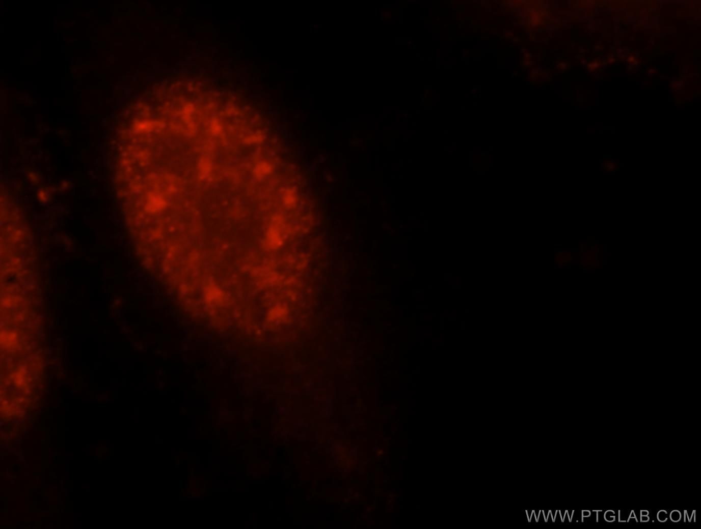 Immunofluorescence (IF) / fluorescent staining of HeLa cells using UBE3A Polyclonal antibody (10344-1-AP)