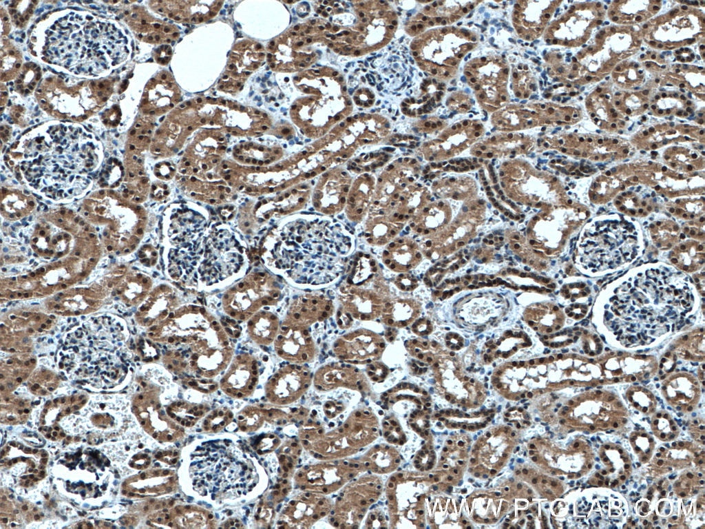 Immunohistochemistry (IHC) staining of human kidney tissue using UBE3A Polyclonal antibody (10344-1-AP)