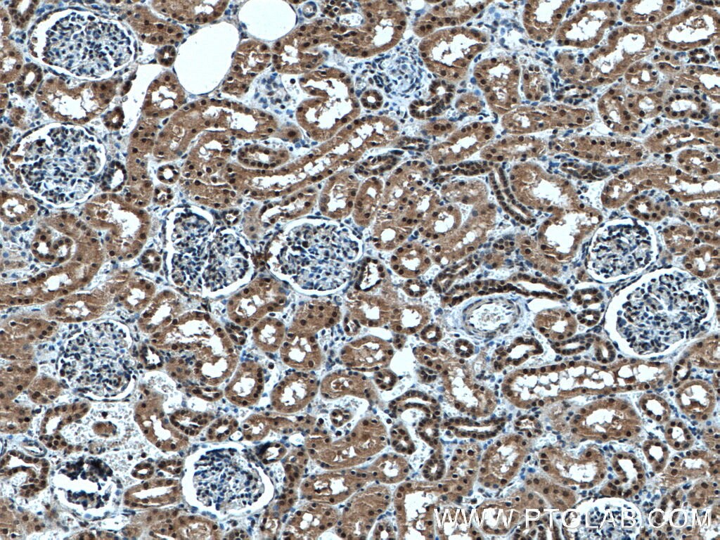 IHC staining of human kidney using 10344-1-AP