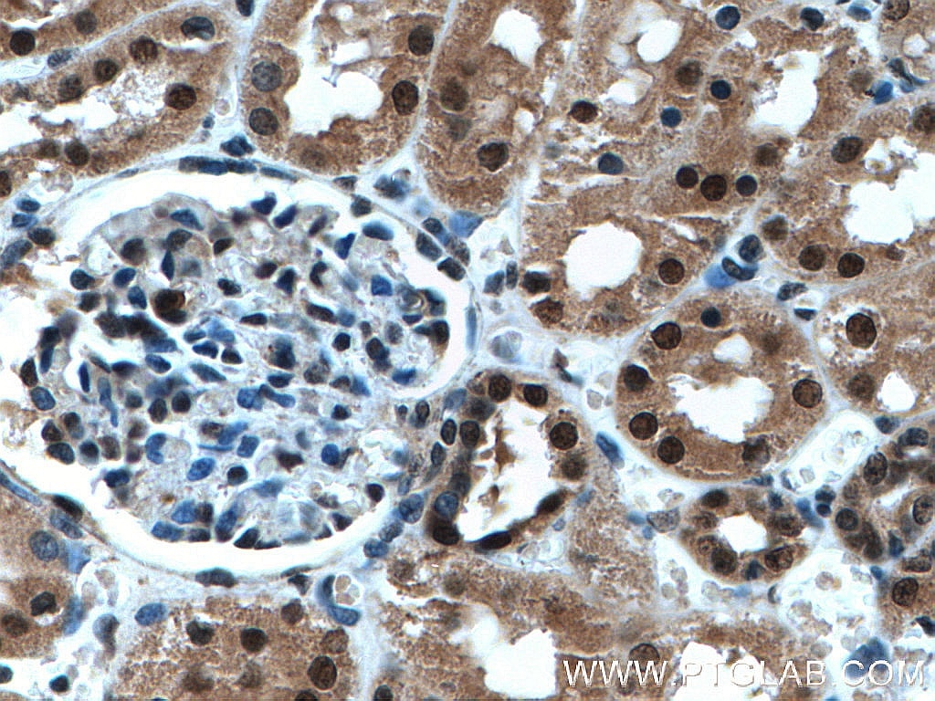 IHC staining of human kidney using 10344-1-AP