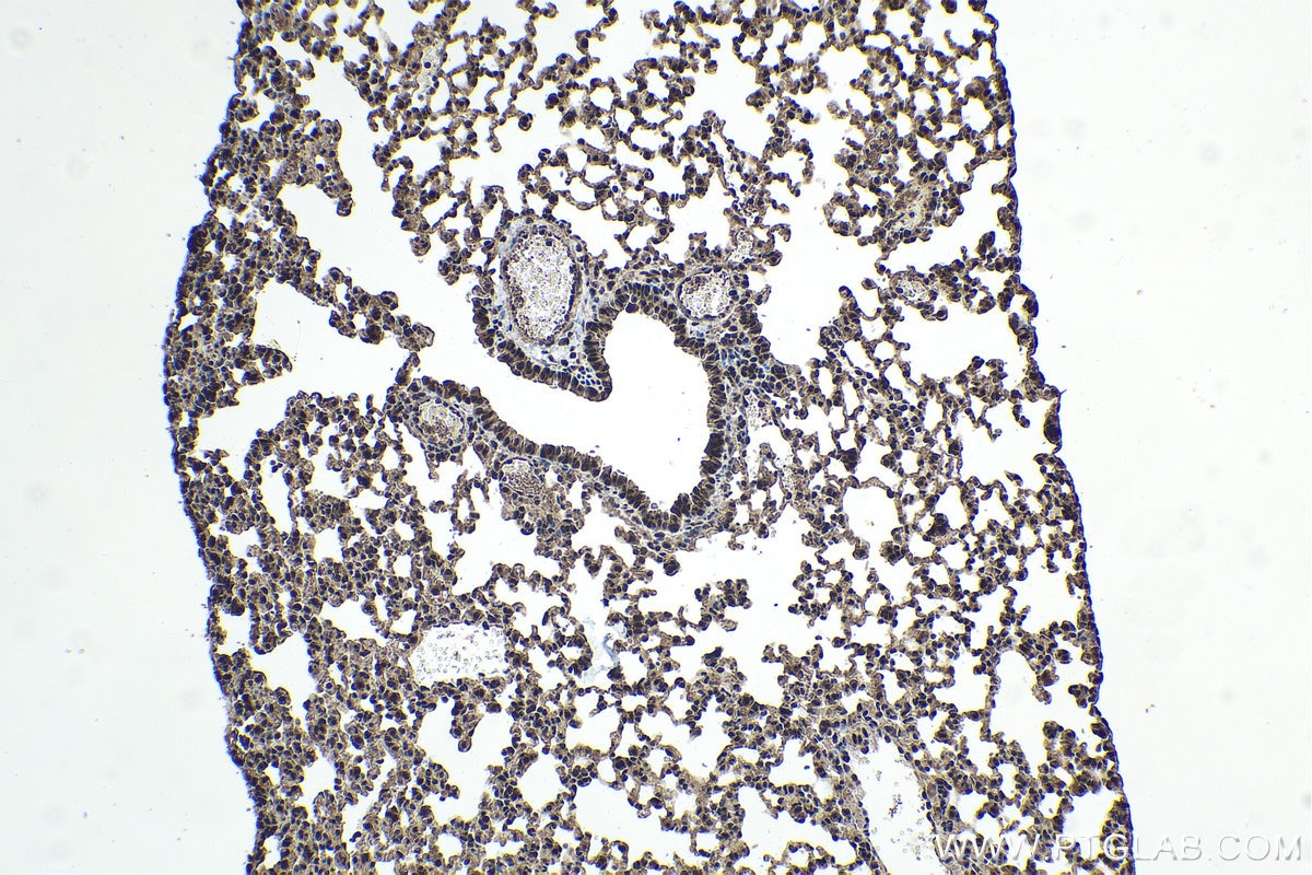 Immunohistochemistry (IHC) staining of mouse lung tissue using UBE3A Polyclonal antibody (10344-1-AP)