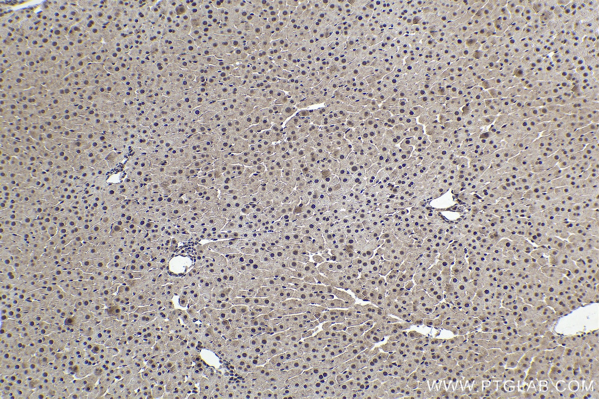 Immunohistochemistry (IHC) staining of rat liver tissue using UBE3A Polyclonal antibody (10344-1-AP)
