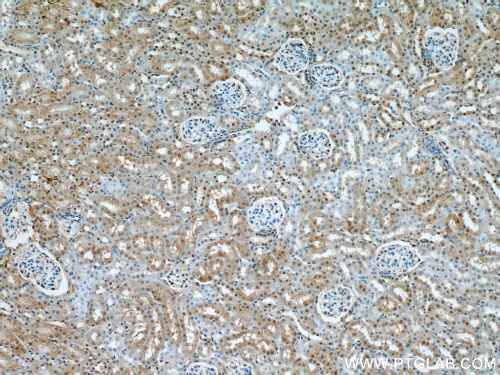 Immunohistochemistry (IHC) staining of mouse kidney tissue using UBE3A Polyclonal antibody (10344-1-AP)