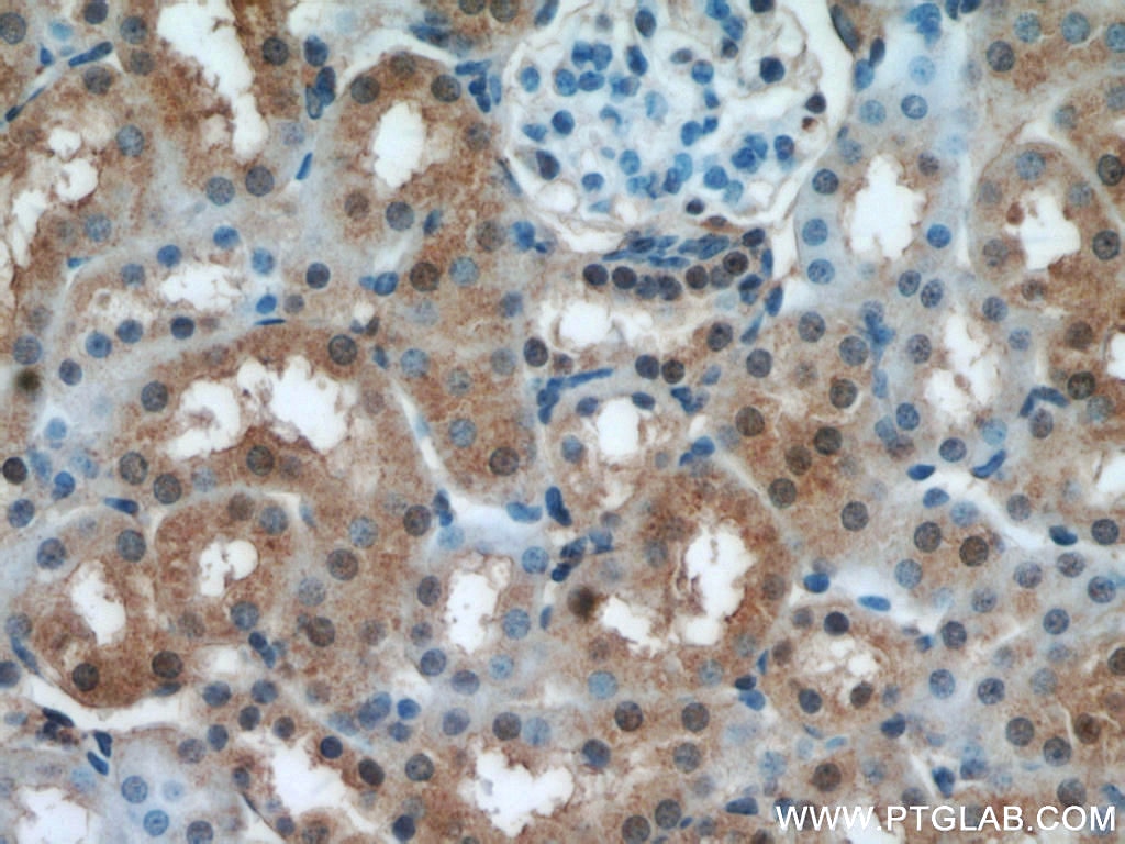 Immunohistochemistry (IHC) staining of mouse kidney tissue using UBE3A Polyclonal antibody (10344-1-AP)