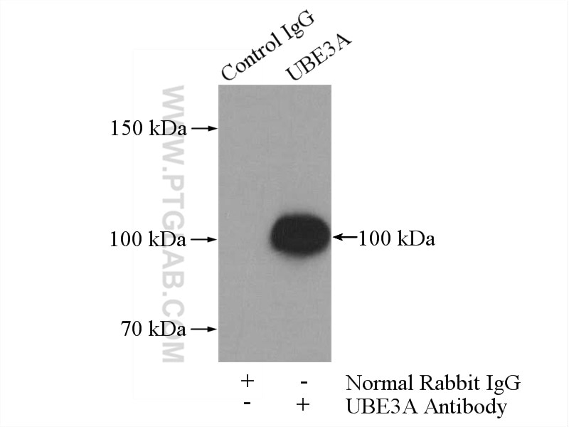 Immunoprecipitation (IP) experiment of mouse brain tissue using UBE3A Polyclonal antibody (10344-1-AP)