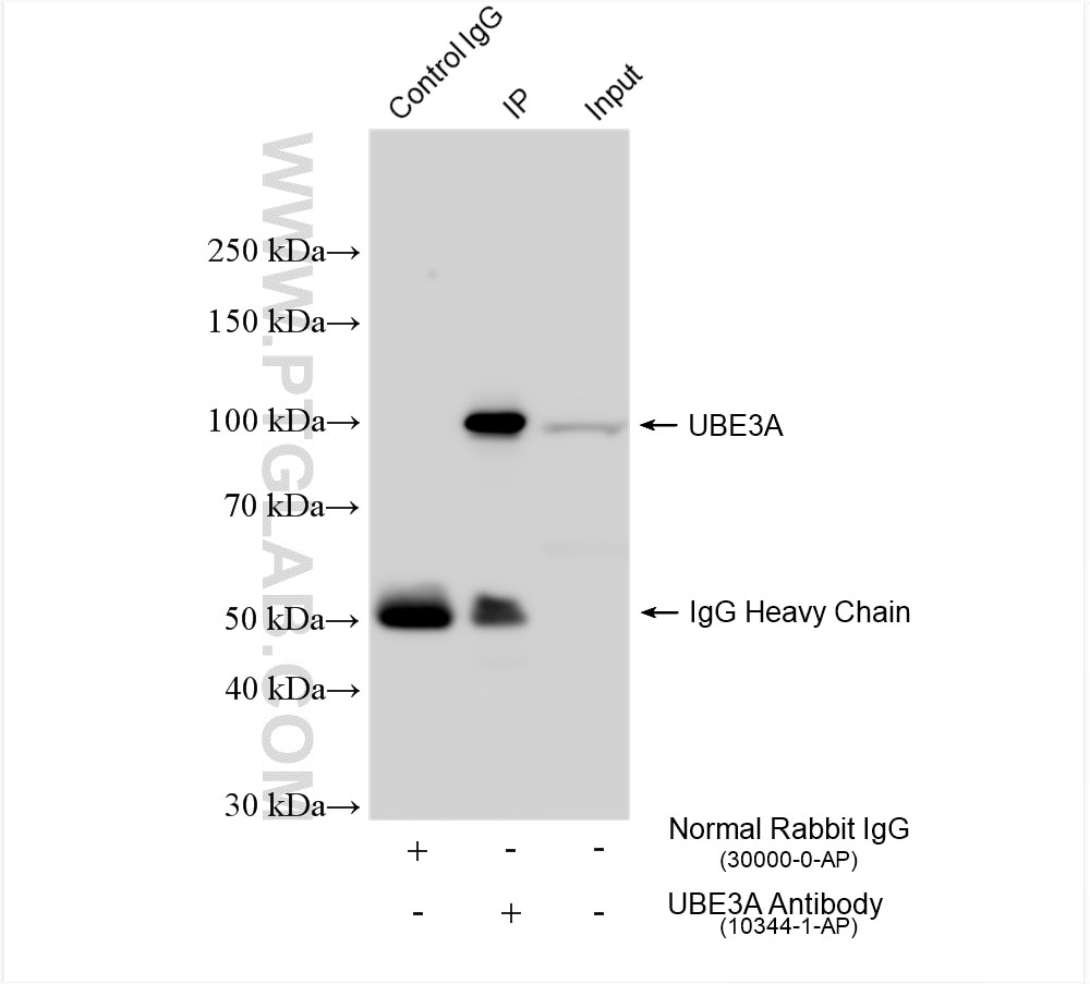 Immunoprecipitation (IP) experiment of K-562 cells using UBE3A Polyclonal antibody (10344-1-AP)