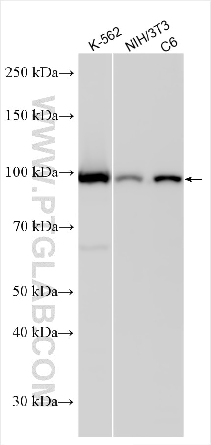 Western Blot (WB) analysis of various lysates using UBE3A Polyclonal antibody (10344-1-AP)