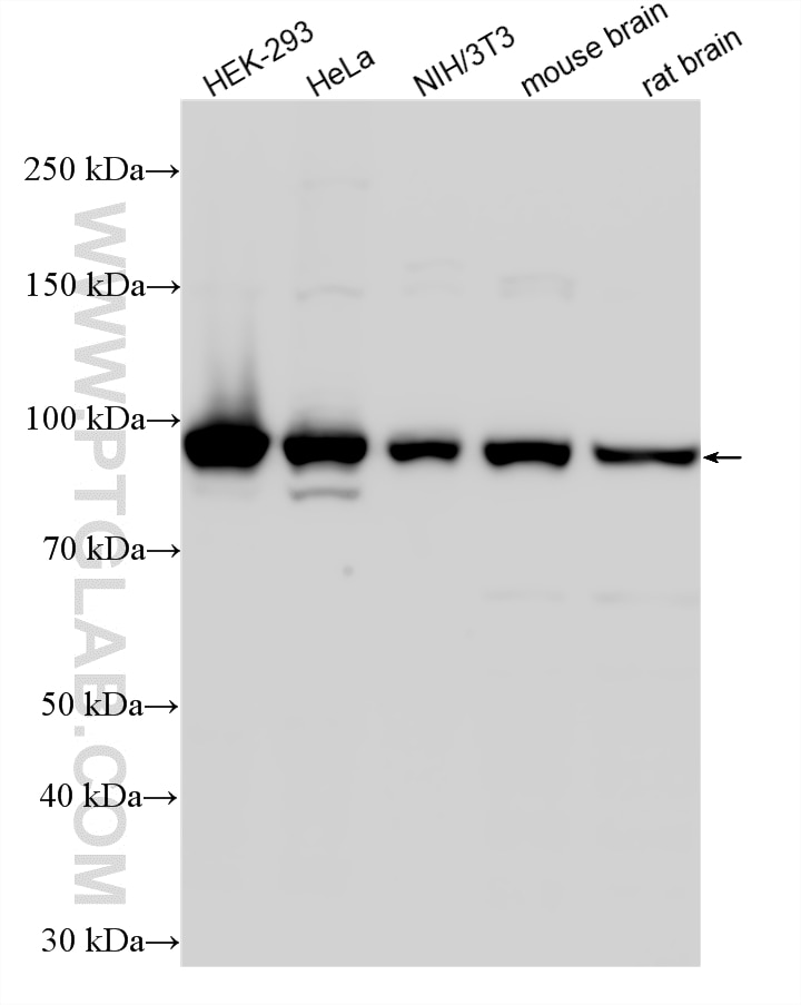 WB analysis using 10344-1-AP Western Blot (WB) analysis of various lysates using UBE3A Polyclonal antibody (10344-1-AP)
