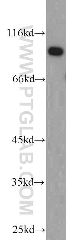 WB analysis of mouse brain using 10344-1-AP