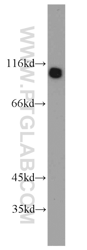 Western Blot (WB) analysis of K-562 cells using UBE3A Polyclonal antibody (10344-1-AP)