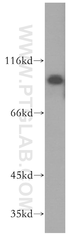 Western Blot (WB) analysis of mouse lung tissue using UBE3A Polyclonal antibody (10344-1-AP)