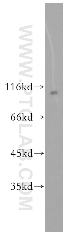 Western Blot (WB) analysis of Jurkat cells using UBE3A Polyclonal antibody (10344-1-AP)