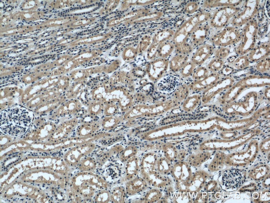 Immunohistochemistry (IHC) staining of human kidney tissue using UBE3A Monoclonal antibody (60038-1-Ig)