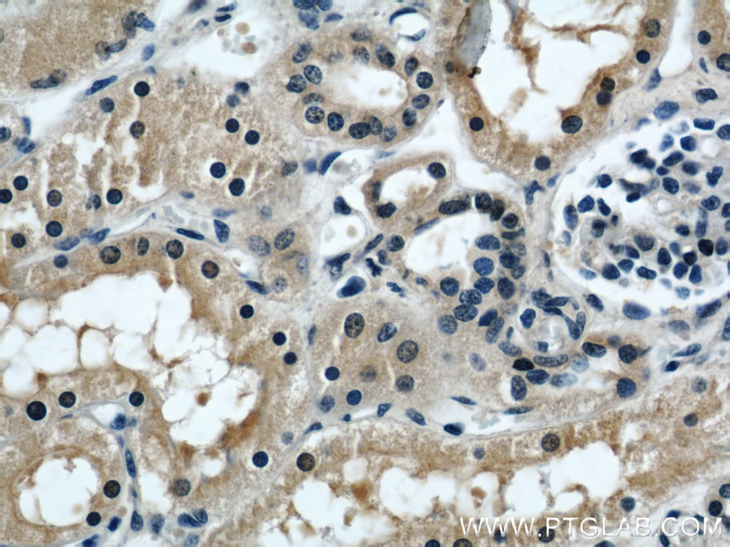 Immunohistochemistry (IHC) staining of human kidney tissue using UBE3A Monoclonal antibody (60038-1-Ig)