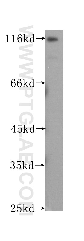 WB analysis of HeLa using 60038-1-Ig