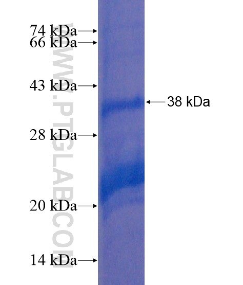 UBE3B fusion protein Ag21405 SDS-PAGE