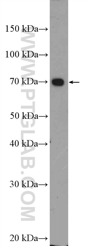 Western Blot (WB) analysis of HepG2 cells using UBE3C Polyclonal antibody (12333-1-AP)