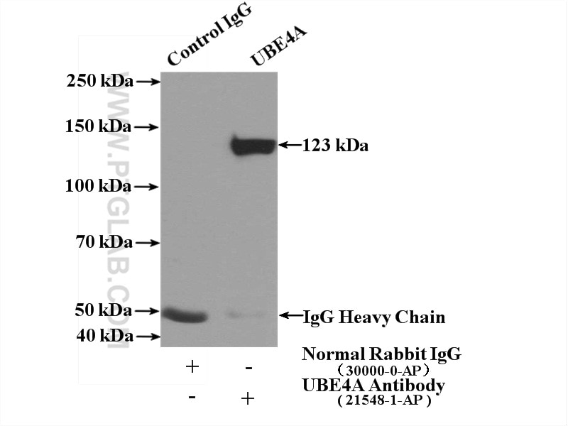 Immunoprecipitation (IP) experiment of mouse brain tissue using UBE4A Polyclonal antibody (21548-1-AP)