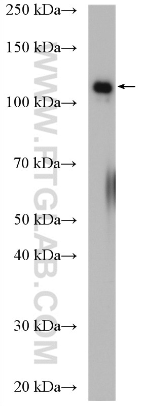 Western Blot (WB) analysis of Jurkat cells using UBE4A Polyclonal antibody (21548-1-AP)