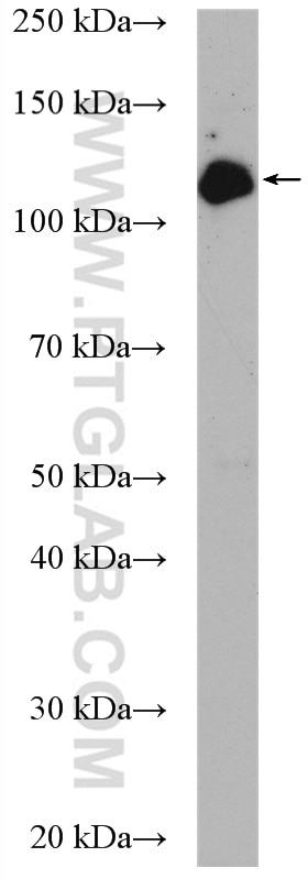 Western Blot (WB) analysis of HepG2 cells using UBE4A Polyclonal antibody (21548-1-AP)