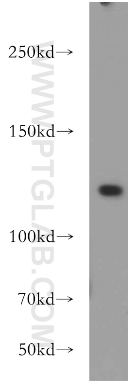 Western Blot (WB) analysis of HEK-293 cells using UBE4A Polyclonal antibody (21548-1-AP)