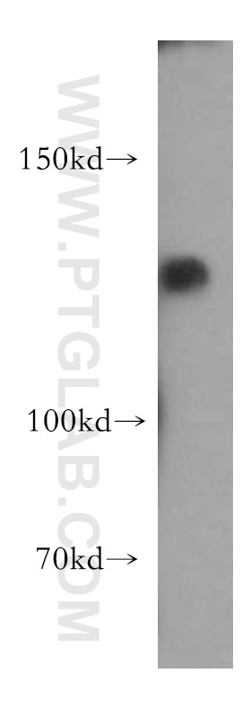 Western Blot (WB) analysis of mouse brain tissue using UBE4A Polyclonal antibody (21548-1-AP)