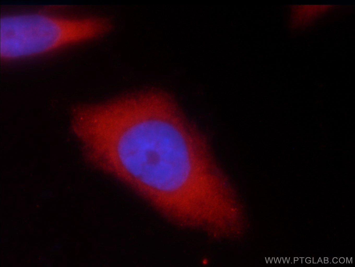 Immunofluorescence (IF) / fluorescent staining of HeLa cells using UBE4B Polyclonal antibody (18148-1-AP)