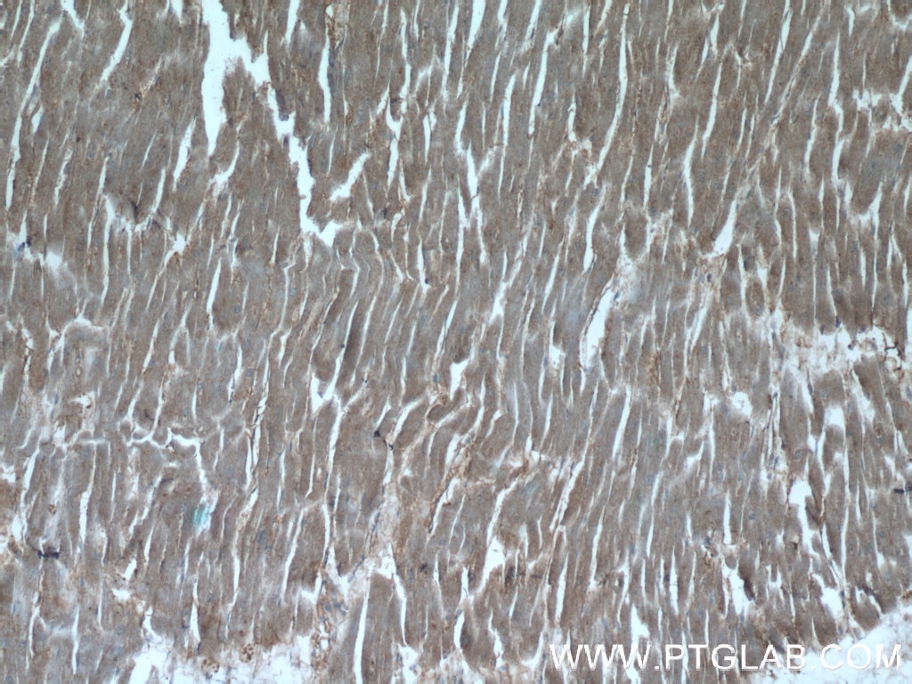 Immunohistochemistry (IHC) staining of human heart tissue using UBE4B Polyclonal antibody (18148-1-AP)