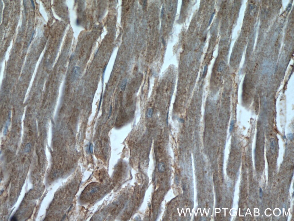 Immunohistochemistry (IHC) staining of human heart tissue using UBE4B Polyclonal antibody (18148-1-AP)