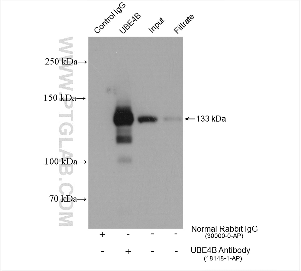 Immunoprecipitation (IP) experiment of HeLa cells using UBE4B Polyclonal antibody (18148-1-AP)