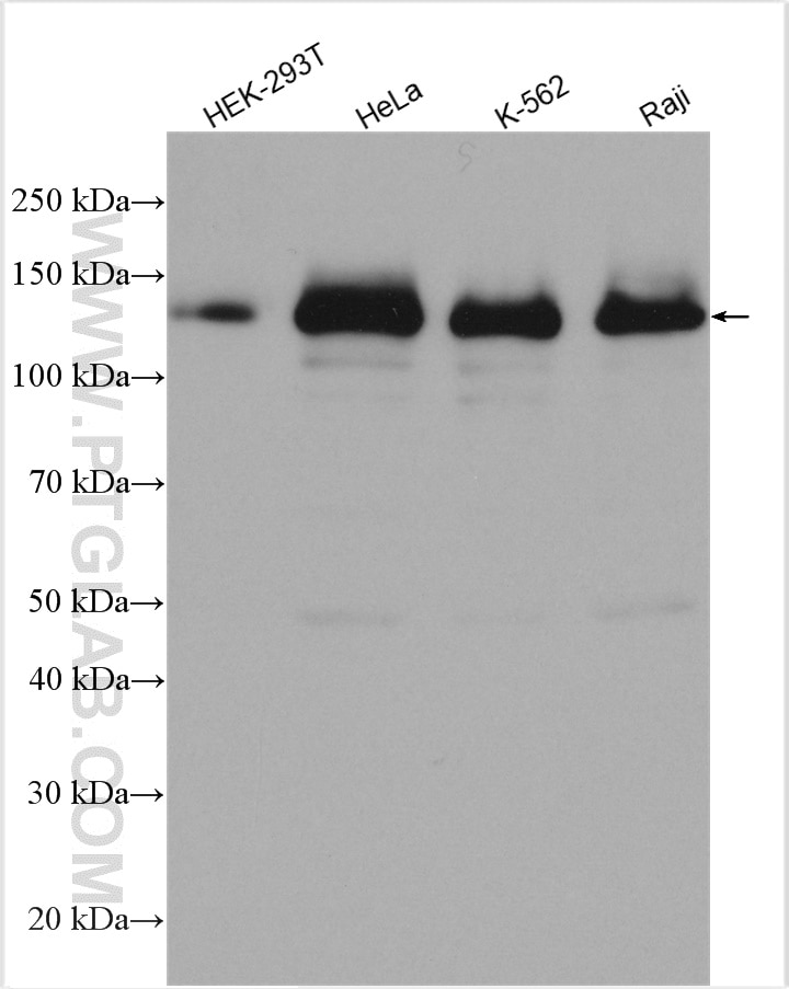 Western Blot (WB) analysis of various lysates using UBE4B Polyclonal antibody (18148-1-AP)