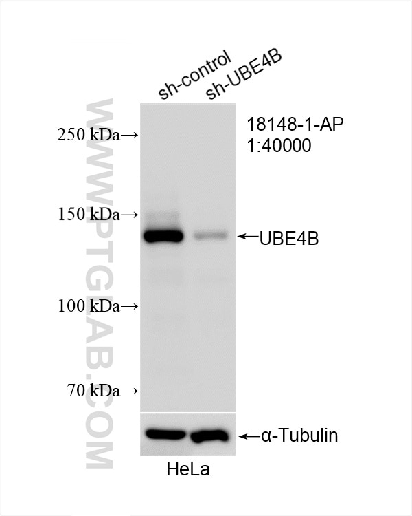 Western Blot (WB) analysis of HeLa cells using UBE4B Polyclonal antibody (18148-1-AP)