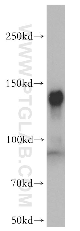 Western Blot (WB) analysis of mouse testis tissue using UBE4B Polyclonal antibody (18148-1-AP)