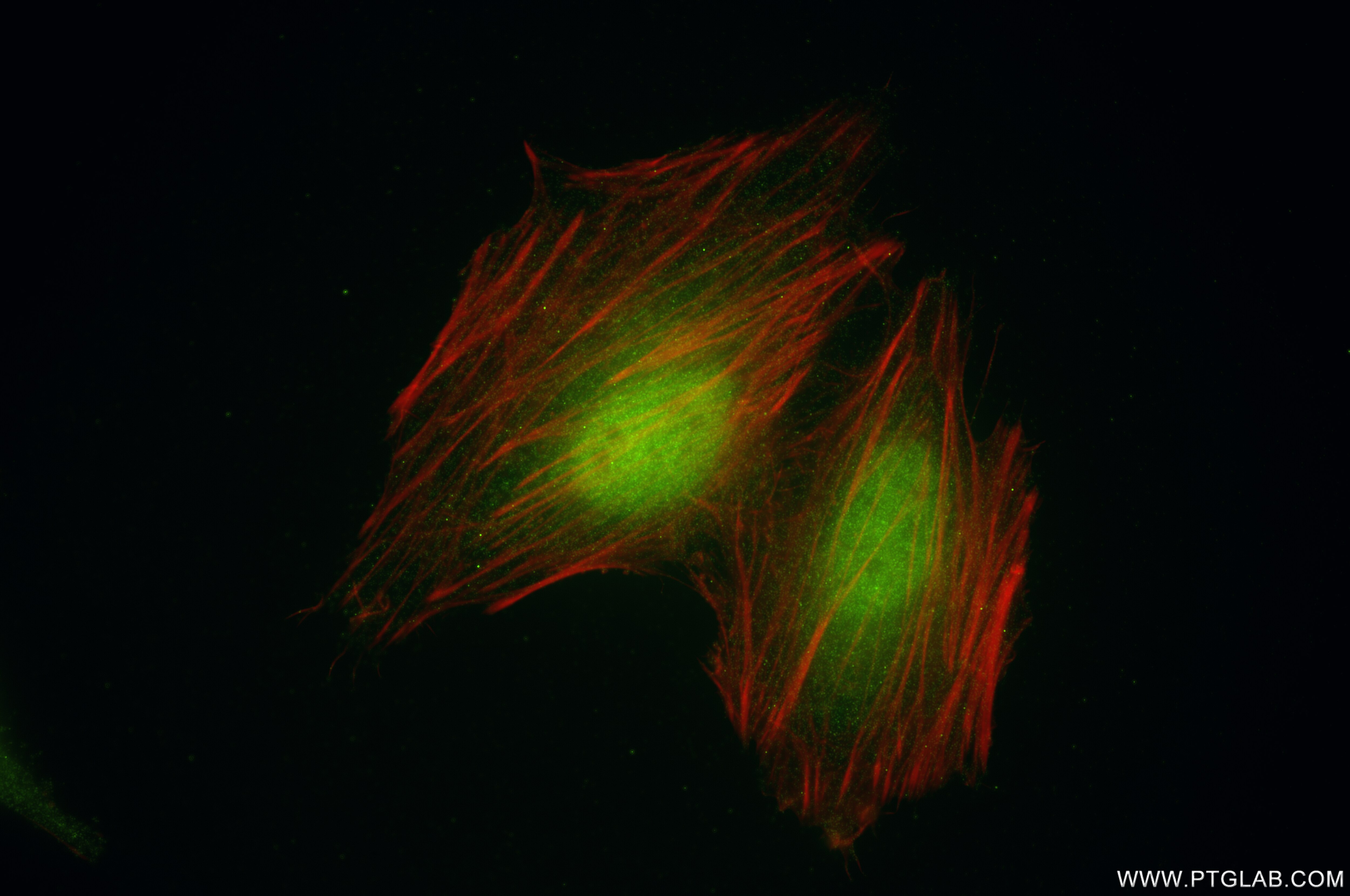 Immunofluorescence (IF) / fluorescent staining of HeLa cells using UBE4B Recombinant antibody (85332-2-RR)